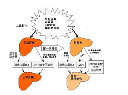 专家深度解析：影响肝癌治疗的因素有哪些