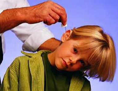 诊断与防治分泌性中耳炎